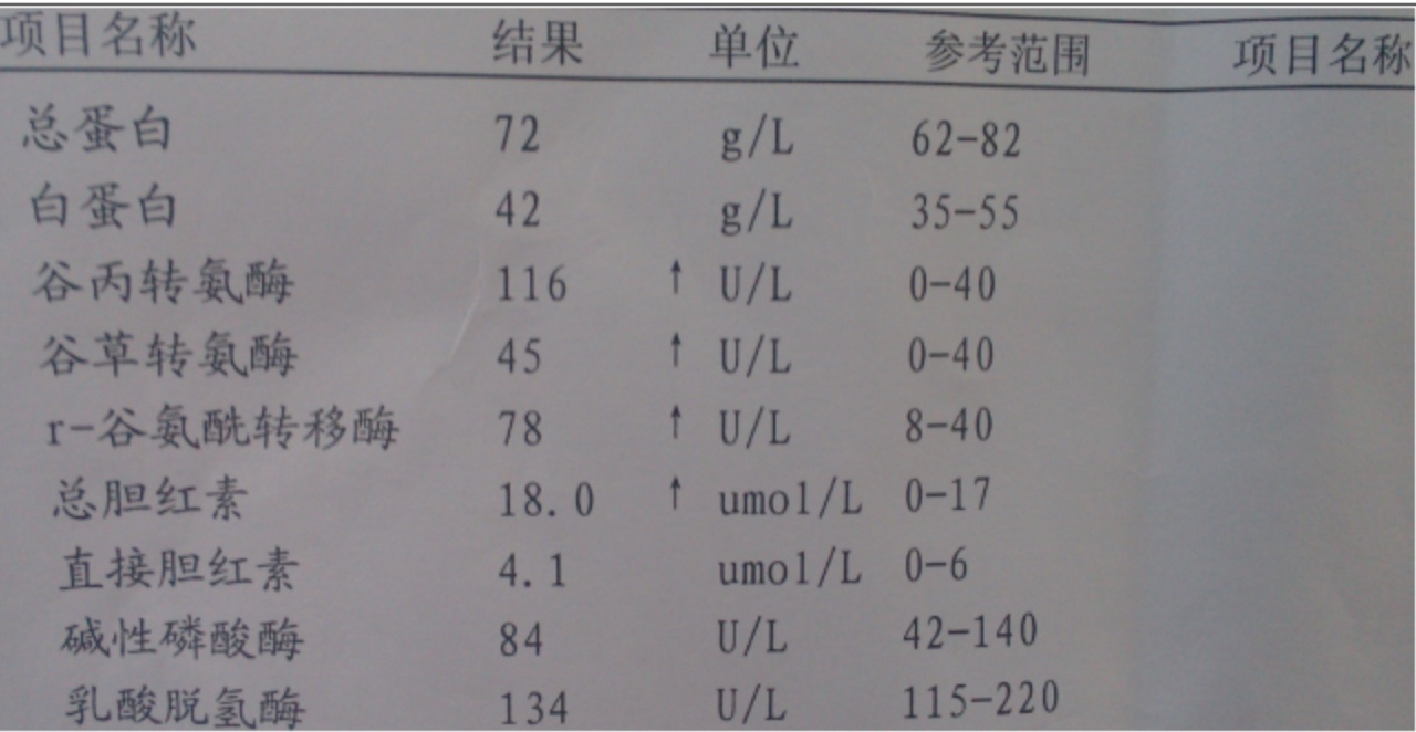 liver_function_tests.jpg